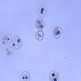 Ragweed Pollen