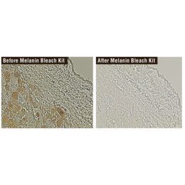 Delicate Melanin Bleach Kit for Special Stains and IHC